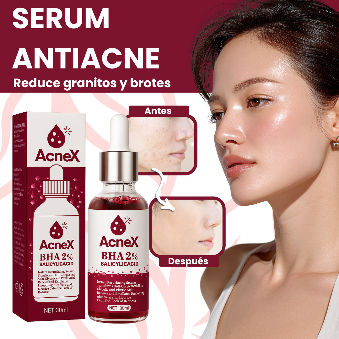 ACNEX | TRATAMIENTO ANTI ACNÉ 7 DÍAS 100% COMPROBADO OFERTA 2X1