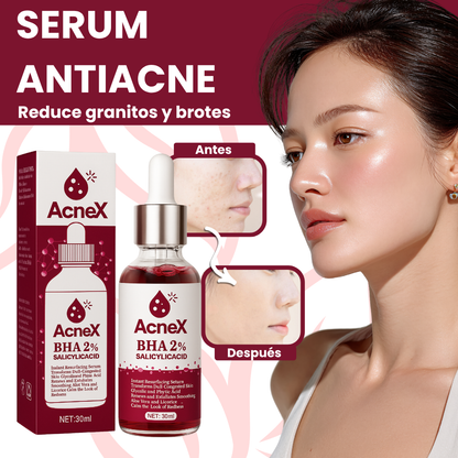 ACNEX | TRATAMIENTO ANTI ACNÉ 7 DÍAS 100% COMPROBADO OFERTA 2X1