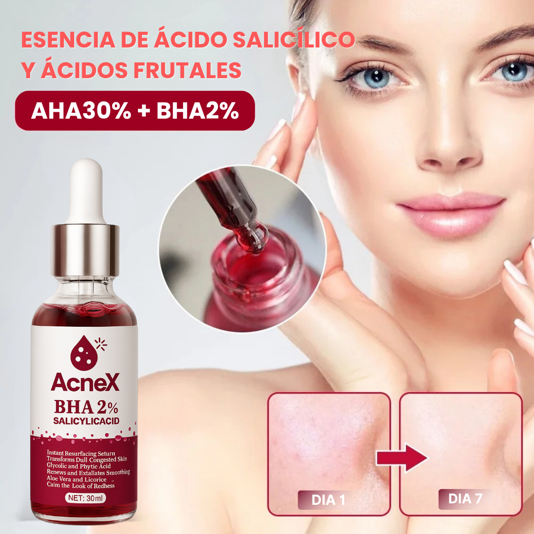 ACNEX | TRATAMIENTO ANTI ACNÉ 7 DÍAS 100% COMPROBADO OFERTA 2X1