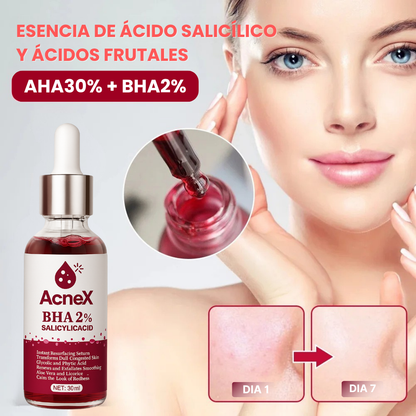 ACNEX | TRATAMIENTO ANTI ACNÉ 7 DÍAS 100% COMPROBADO OFERTA 2X1