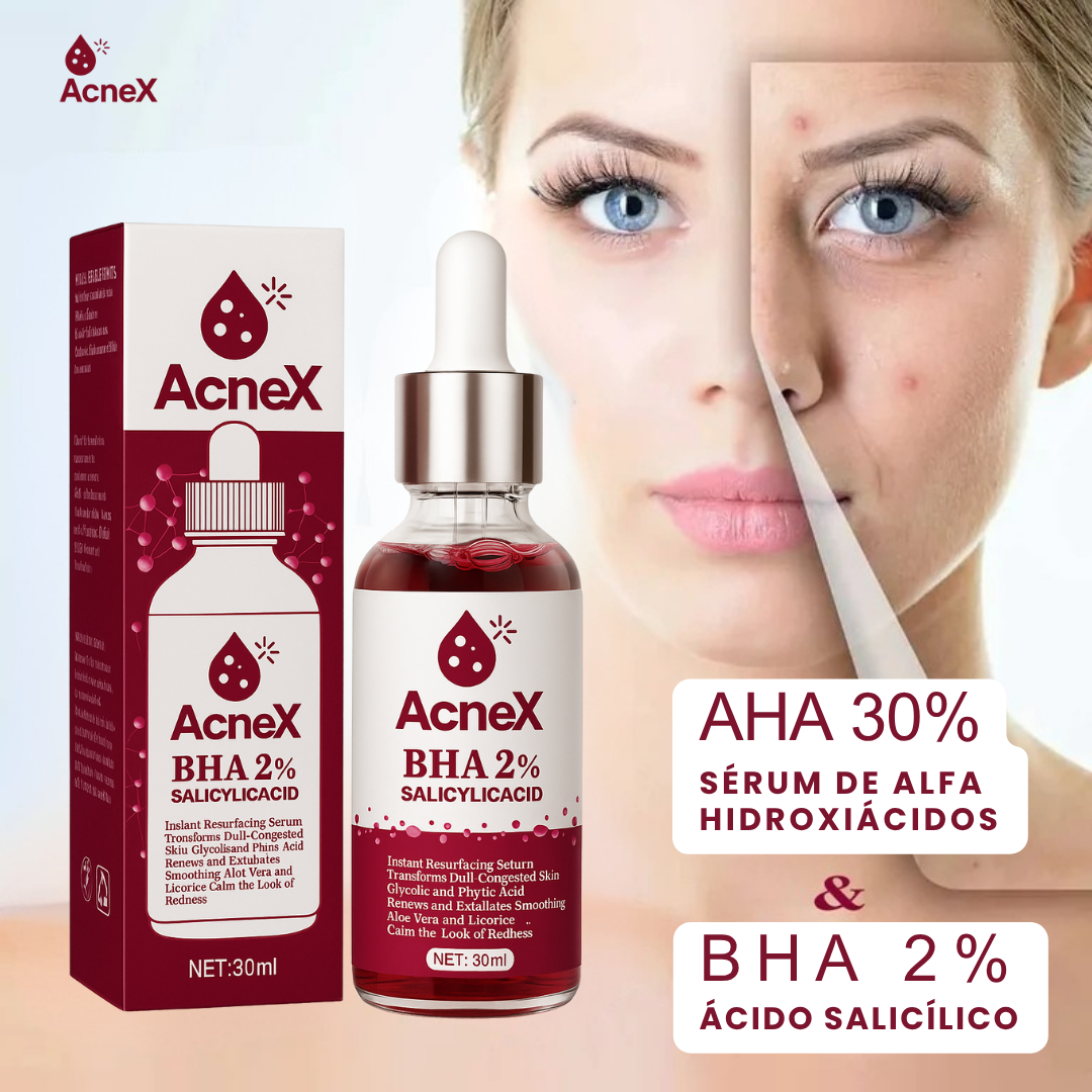 ACNEX | TRATAMIENTO ANTI ACNÉ 7 DÍAS 100% COMPROBADO OFERTA 2X1