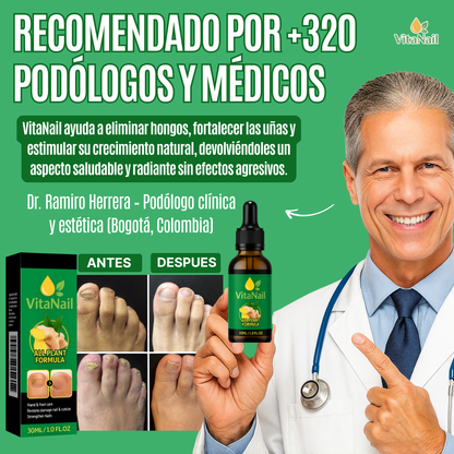VITANAIL | TRATAMIENTO ANTI HONGOS 7 DÍAS 100% NATURAL OFERTA 2X1